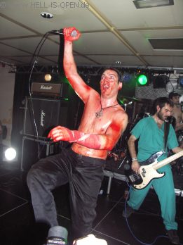 HAEMORRHAGE