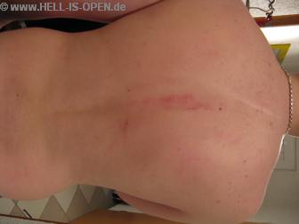 Leichte Blessuren durch den Moshpit bei den Fans