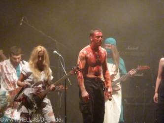 Haemorrhage